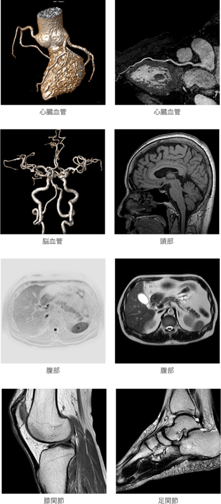 高分解能画像例